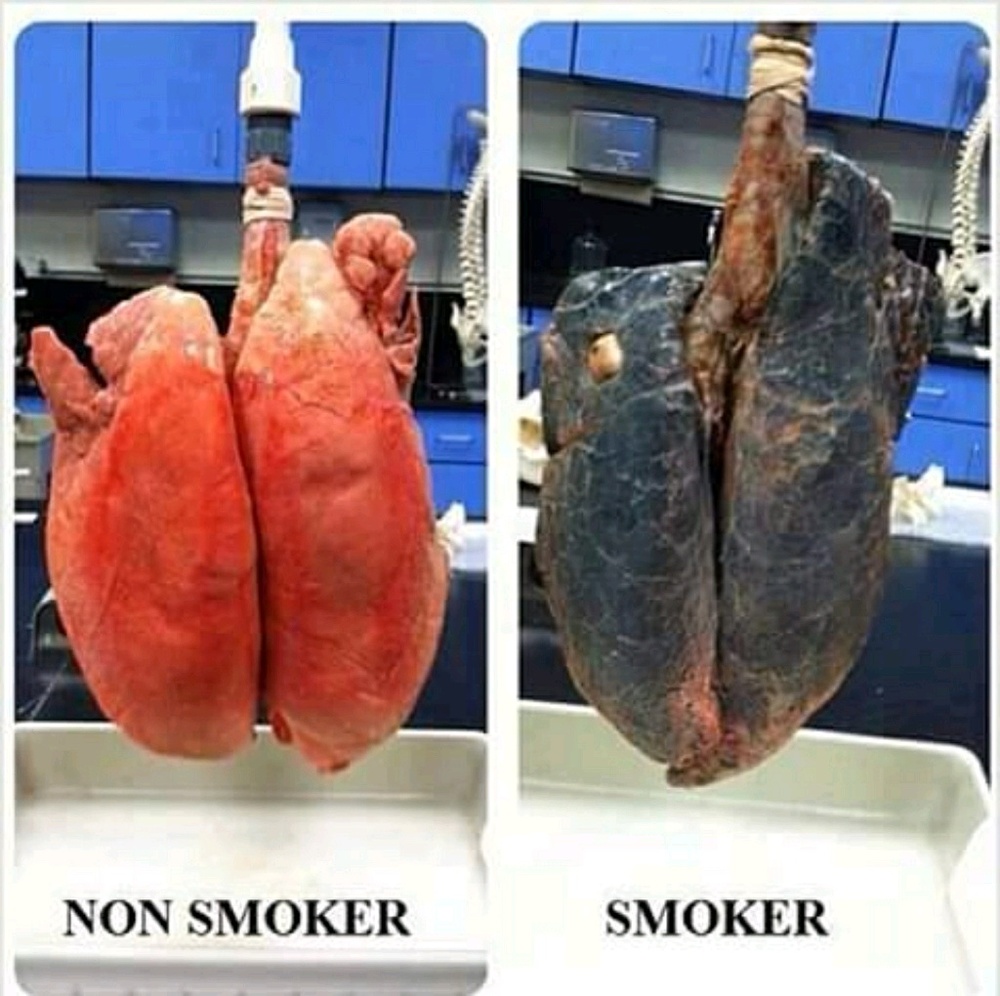 Meet your Posher, Smile